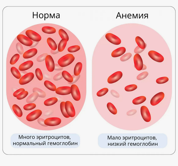 гемоглобин гемоглобин